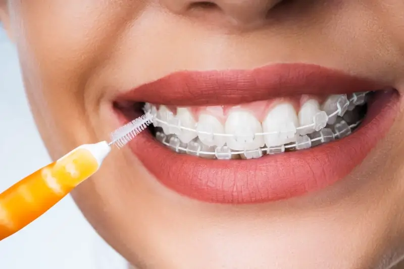 Najlepsze leczenie kanałowe Szczecin